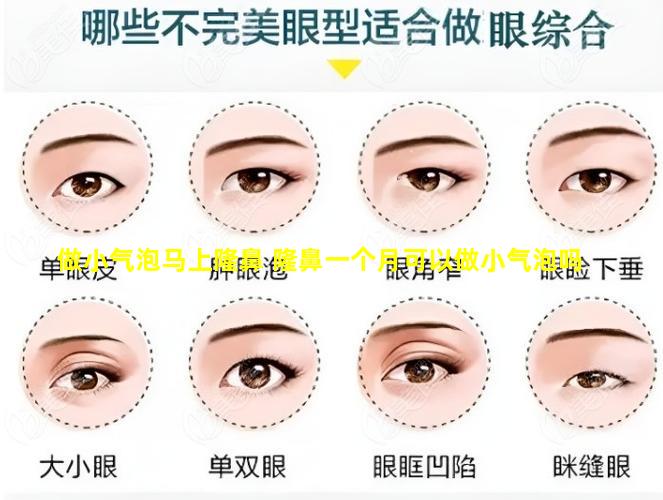 做小气泡马上隆鼻 隆鼻一个月可以做小气泡吗